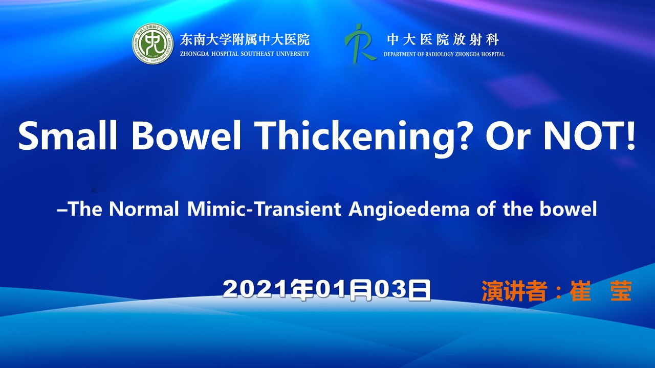 Small Bowel Thickening?Or NOT! -The Normal Mimic-Transient Angioedema of the bowel